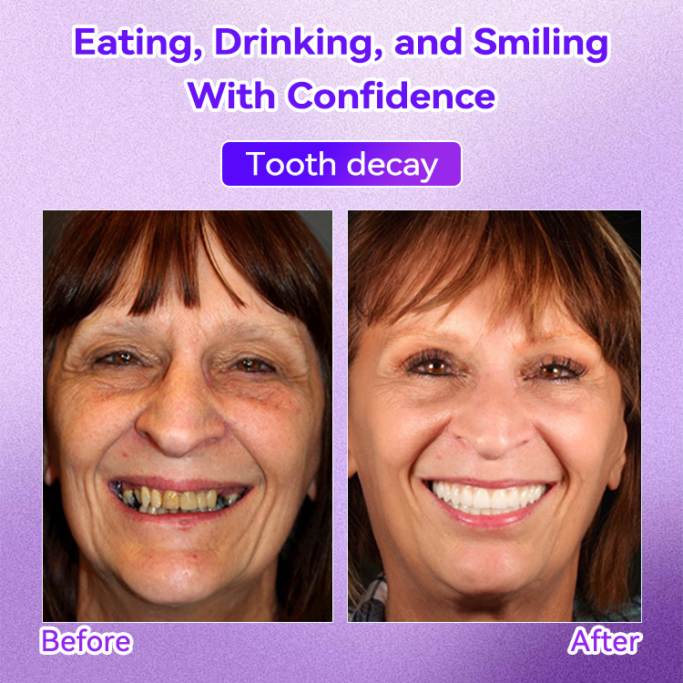 𝐎𝐲𝐢𝐤𝐞𝐲® 💕Mineral Whitening Tooth Powder  (🎁 Exclusive Promotion - 60% Off)