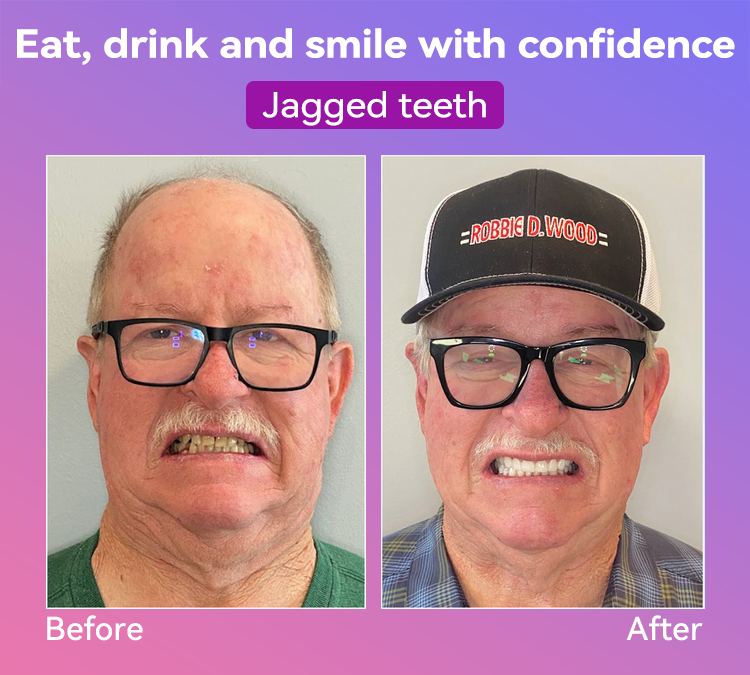 𝐉𝐚𝐬𝐬𝐞𝐞𝐦® Latest Premium Comfort Dentures🎉 (High-End Dentures, Easy to Wear - Limited Time 70% Discount)🔥