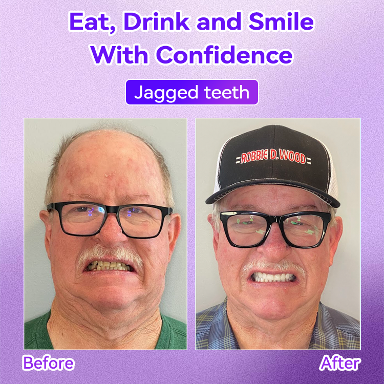 𝐎𝐲𝐢𝐤𝐞𝐲® 💕Mineral Whitening Tooth Powder  (🎁 Exclusive Promotion - 60% Off)