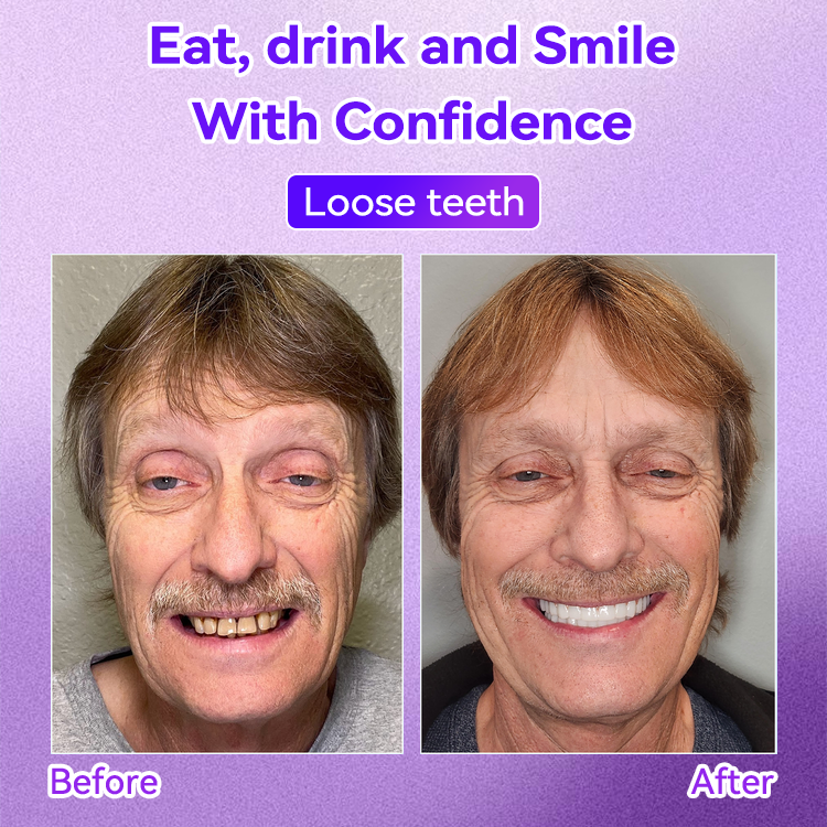 𝐎𝐲𝐢𝐤𝐞𝐲® 💕Mineral Whitening Tooth Powder  (🎁 Exclusive Promotion - 60% Off)