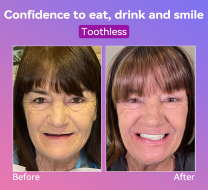 𝐉𝐚𝐬𝐬𝐞𝐞𝐦®👩‍⚕️🎁𝐍𝐞𝐱𝐭-𝐆𝐞𝐧 𝐂𝐨𝐦𝐟𝐨𝐫𝐭 𝐃𝐞𝐧𝐭𝐮𝐫𝐞(🦷𝐋𝐢𝐦𝐢𝐭𝐞𝐝 𝐭𝐢𝐦𝐞 𝐝𝐢𝐬𝐜𝐨𝐮𝐧𝐭 𝐋𝐚𝐬𝐭 𝟑𝟎 𝐦𝐢𝐧𝐮𝐭𝐞𝐬🦷)
