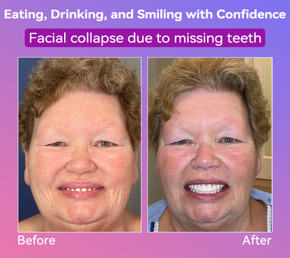 𝐉𝐚𝐬𝐬𝐞𝐞𝐦® Latest Premium Comfort Dentures🎉 (High-End Dentures, Easy to Wear - Limited Time 70% Discount)🔥