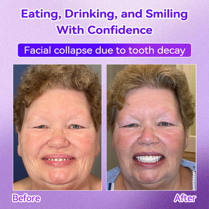 𝐎𝐲𝐢𝐤𝐞𝐲® 💕Mineral Whitening Tooth Powder  (🎁 Exclusive Promotion - 60% Off)