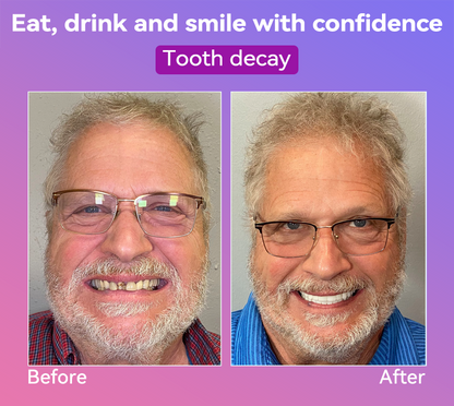 𝐉𝐚𝐬𝐬𝐞𝐞𝐦® Latest Premium Comfort Dentures🎉 (High-End Dentures, Easy to Wear - Limited Time 70% Discount)🔥