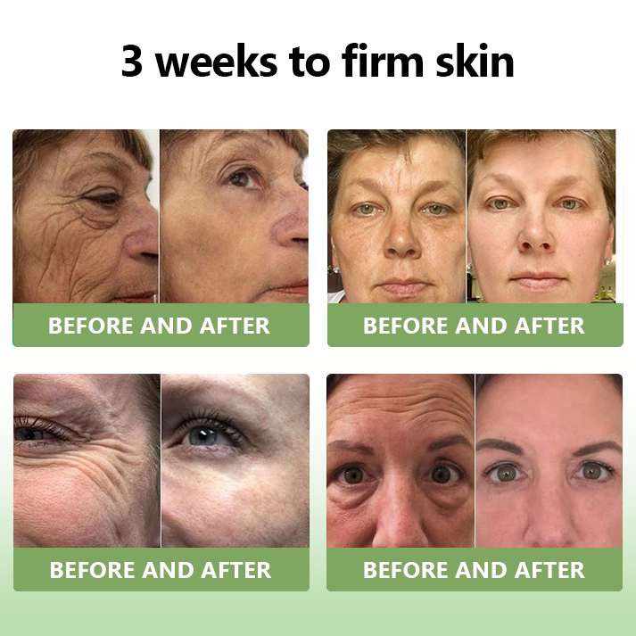 (Official Store) STDEI®  Natural Collagen Firming Cream 🎁🎁