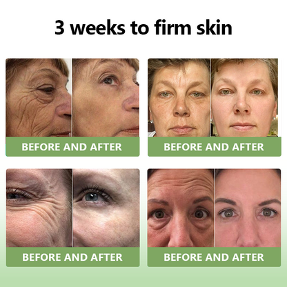 (Official Store) STDEI®  Natural Collagen Firming Cream 🎁🎁