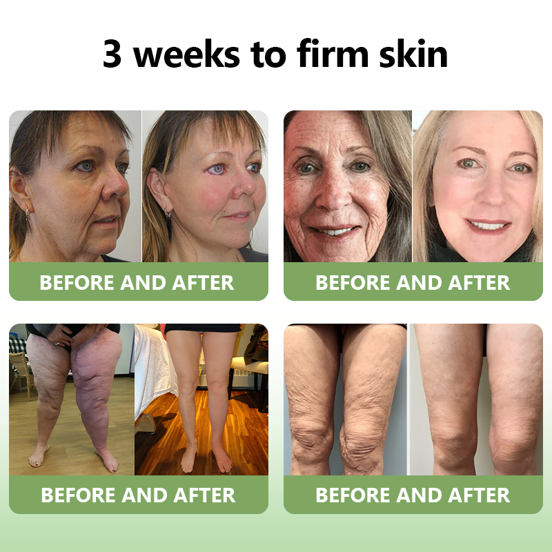 (Official Store) STDEI®  Natural Collagen Firming Cream 🎁🎁