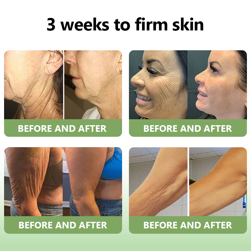 (Official Store) STDEI®  Natural Collagen Firming Cream 🎁🎁