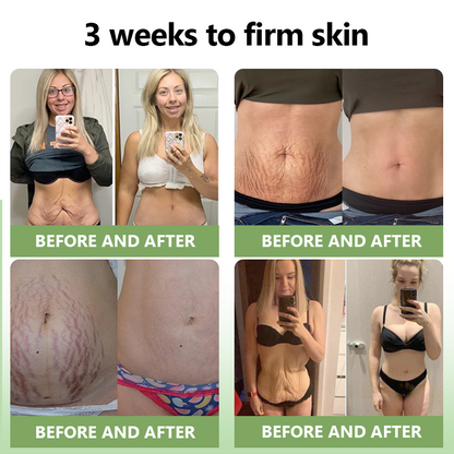 (Official Store) STDEI®  Natural Collagen Firming Cream 🎁🎁