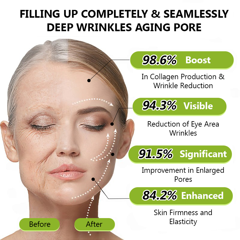 STDEI® BOTOX & VITA A RETINOL SHOT Anti-Wrinkle Lifting & Firming Cream🎁🎁