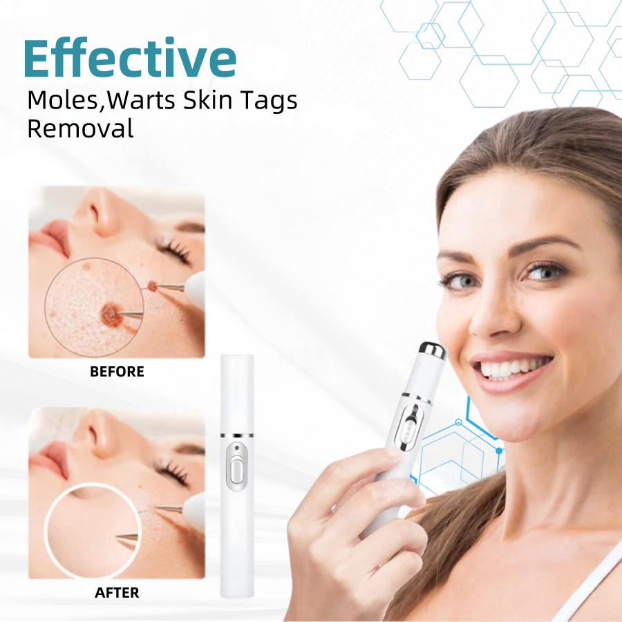 𝐉𝐚𝐬𝐬𝐞𝐞𝐦® Medical-Grade Laser Pen 🏆 (Powered by CO₂ laser technology – effectively removes moles, warts, skin tags, pigmentation spots, and other skin imperfections)🔥