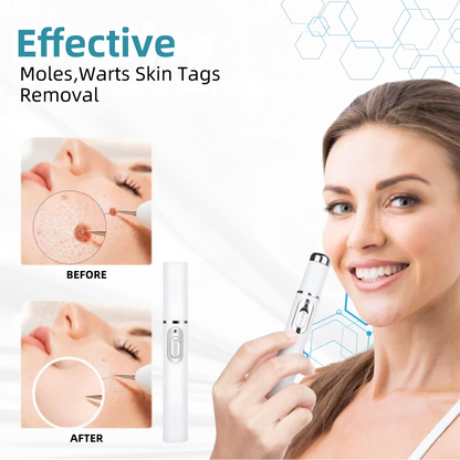 𝐉𝐚𝐬𝐬𝐞𝐞𝐦® Medical-Grade Laser Pen 🏆 (Powered by CO₂ laser technology – effectively removes moles, warts, skin tags, pigmentation spots, and other skin imperfections)🔥