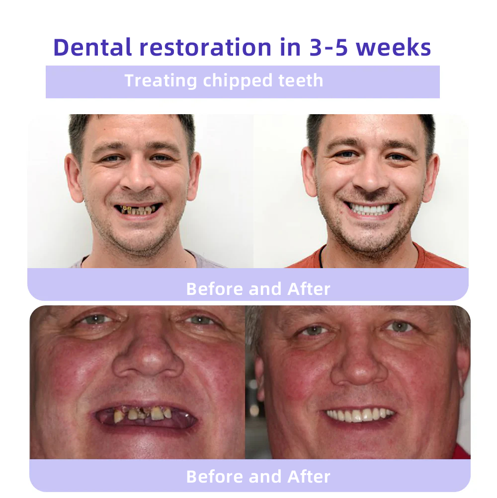 Oyikey® 🎁Tooth Restoration Mineral Powder (Whitening, Restoring Tooth Health)