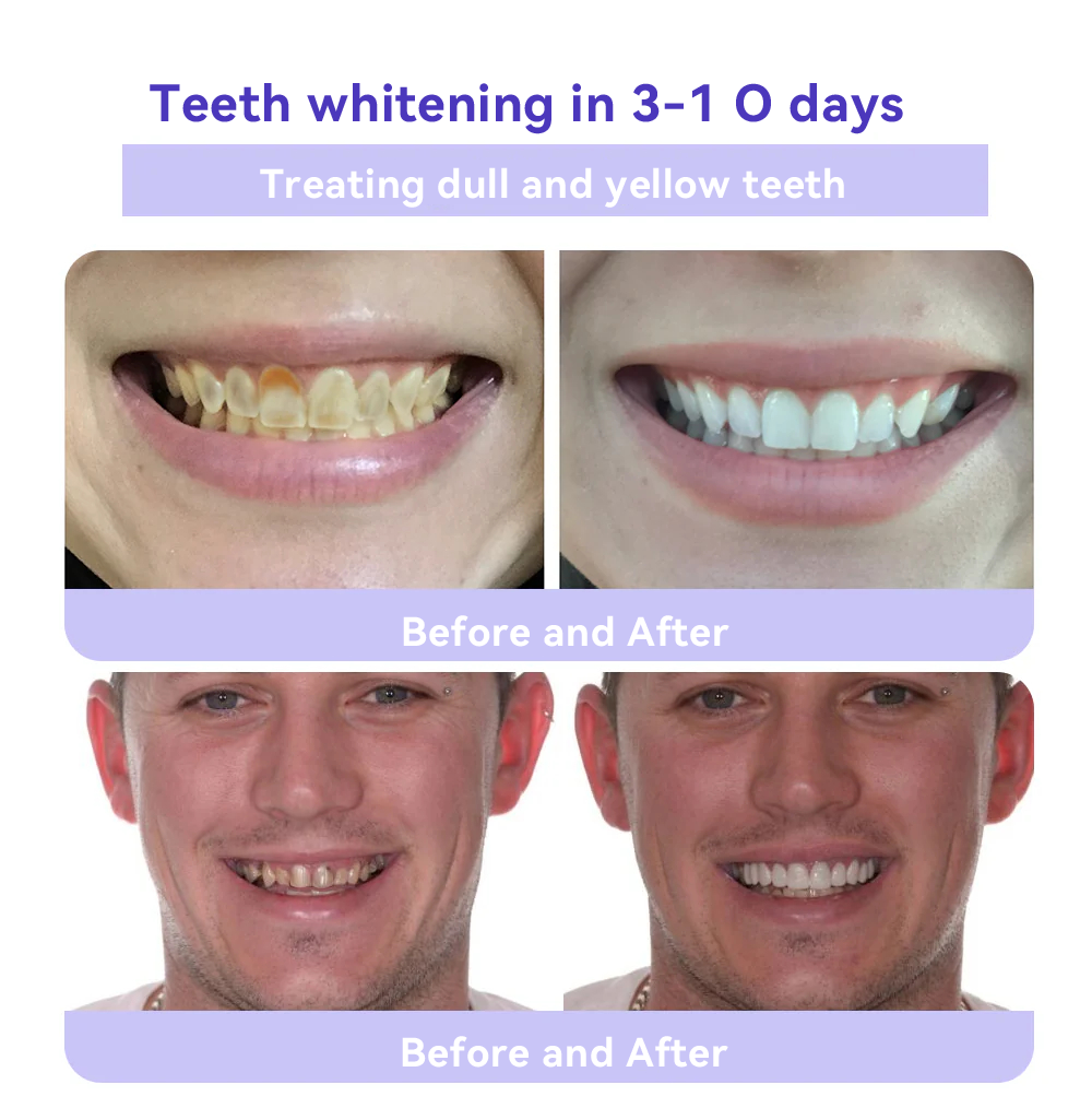 Oyikey® 🎁Tooth Restoration Mineral Powder (Whitening, Restoring Tooth Health)