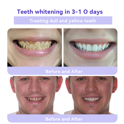 Oyikey® 🎁Tooth Restoration Mineral Powder (Whitening, Restoring Tooth Health)