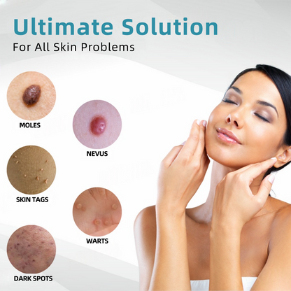 𝐉𝐚𝐬𝐬𝐞𝐞𝐦® Medical-Grade Laser Pen 🏆 (Powered by CO₂ laser technology – effectively removes moles, warts, skin tags, pigmentation spots, and other skin imperfections)🔥