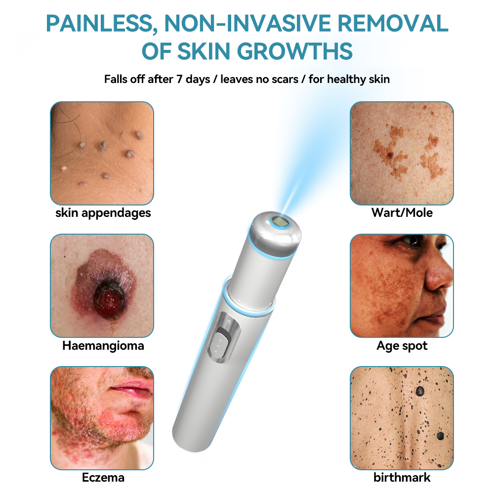 𝐉𝐚𝐬𝐬𝐞𝐞𝐦® Medical-Grade Laser Pen 🏆 (Powered by CO₂ laser technology – effectively removes moles, warts, skin tags, pigmentation spots, and other skin imperfections)🔥