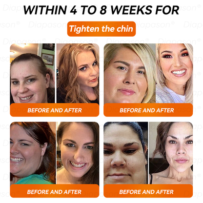 𝐷𝑖𝑎𝑝𝑎𝑠𝑜𝑛® 𝑁𝐴𝐷+ 𝐺𝐿𝑃-1 Slimming Drops 💧 - Suitable for Obesity, Diabetes, and Cardiovascular Diseases