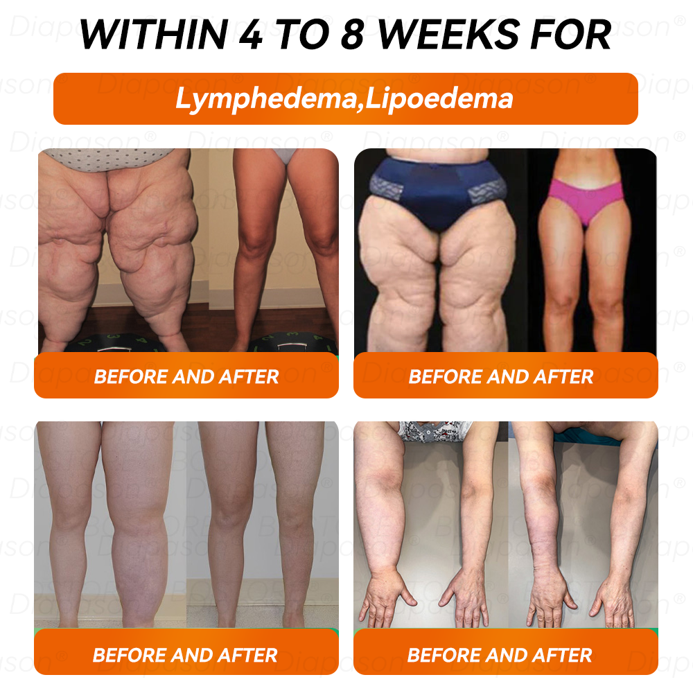 𝐷𝑖𝑎𝑝𝑎𝑠𝑜𝑛® 𝑁𝐴𝐷+ 𝐺𝐿𝑃-1 Slimming Drops 💧 - Suitable for Obesity, Diabetes, and Cardiovascular Diseases