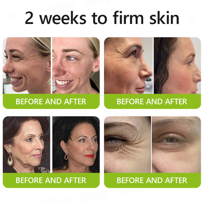 STDEI® BOTOX & VITA A RETINOL SHOT Anti-Wrinkle Lifting & Firming Cream🎁🎁