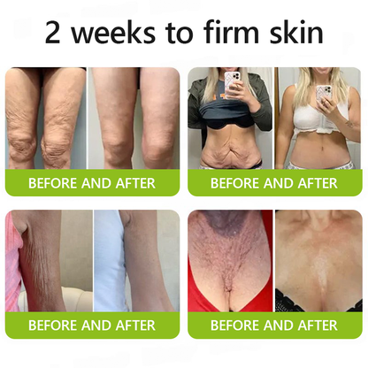 STDEI® BOTOX & VITA A RETINOL SHOT Anti-Wrinkle Lifting & Firming Cream🎁🎁