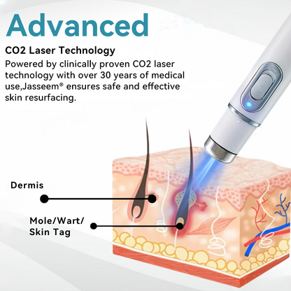 𝐉𝐚𝐬𝐬𝐞𝐞𝐦® Medical-Grade Laser Pen 🏆 (Powered by CO₂ laser technology – effectively removes moles, warts, skin tags, pigmentation spots, and other skin imperfections)🔥
