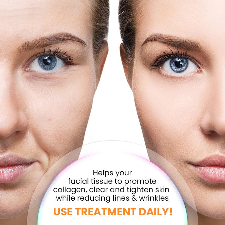 (🔥LAST DAY 70% OFF 🔥) Korean Technology Soluble Collagen Film